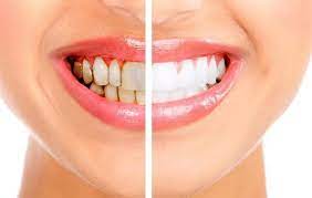 COSMETIC DENTISTRY CLINIC