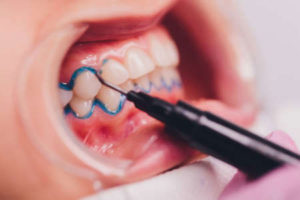 Teeth Whitening Clinic