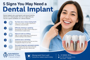 5 Signs You May Need a Dental Implant