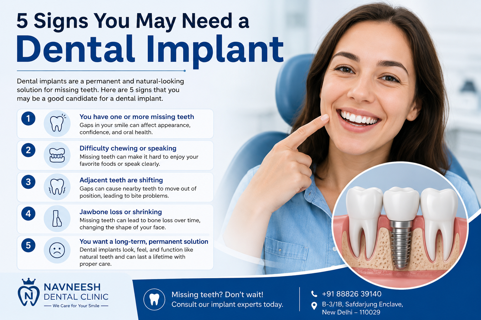 5 Signs You May Need a Dental Implant